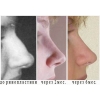 Вы хотели бы изменить размер или форму носа?  Ринопластика - Крым