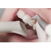 Чистка зубов AirFlow в стоматологии Дент Престиж